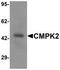 Cytidine/Uridine Monophosphate Kinase 2 antibody, TA320098, Origene, Western Blot image 