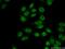 Integrator Complex Subunit 3 antibody, 16620-1-AP, Proteintech Group, Immunofluorescence image 