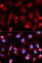 Fli-1 Proto-Oncogene, ETS Transcription Factor antibody, orb167476, Biorbyt, Immunocytochemistry image 