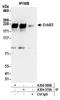 Receptor tyrosine-protein kinase erbB-3 antibody, A304-370A, Bethyl Labs, Immunoprecipitation image 
