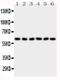P21 (RAC1) Activated Kinase 1 antibody, PA1563, Boster Biological Technology, Western Blot image 