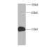 Fatty Acid Binding Protein 5 antibody, FNab02934, FineTest, Western Blot image 