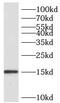 Succinate Dehydrogenase Complex Subunit C antibody, FNab07671, FineTest, Western Blot image 