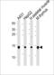 Ubiquitin-conjugating enzyme E2 D1 antibody, LS-B8983, Lifespan Biosciences, Western Blot image 
