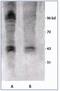 Phospho-threonine antibody, AP03034SU-N, Origene, Western Blot image 