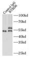 BTB Domain Containing 6 antibody, FNab00973, FineTest, Immunoprecipitation image 