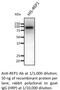 CHM Rab Escort Protein antibody, AB0123-500, SICGEN, Western Blot image 