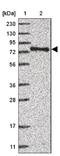Zinc finger MYM-type protein 2 antibody, NBP1-84685, Novus Biologicals, Western Blot image 