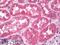 Clathrin Light Chain A antibody, LS-B8521, Lifespan Biosciences, Immunohistochemistry paraffin image 