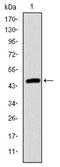Troponin I2, Fast Skeletal Type antibody, AM06686SU-N, Origene, Western Blot image 