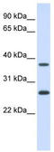 Family With Sequence Similarity 156 Member B antibody, TA343800, Origene, Western Blot image 