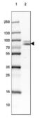 Src substrate protein p85 antibody, NBP2-38826, Novus Biologicals, Western Blot image 
