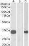 Calsenilin antibody, LS-C154803, Lifespan Biosciences, Western Blot image 