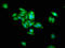 Preferentially Expressed Antigen In Melanoma antibody, LS-C370151, Lifespan Biosciences, Immunofluorescence image 