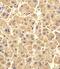 Ubiquitin Conjugating Enzyme E2 D1 antibody, MBS9208161, MyBioSource, Immunohistochemistry frozen image 