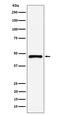 26S protease regulatory subunit 8 antibody, M05480-1, Boster Biological Technology, Western Blot image 