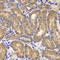 NME/NM23 Nucleoside Diphosphate Kinase 2 antibody, A7443, ABclonal Technology, Immunohistochemistry paraffin image 