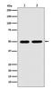 Lysyl Oxidase antibody, M00575, Boster Biological Technology, Western Blot image 