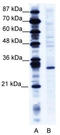Ring Finger Protein 141 antibody, TA335560, Origene, Western Blot image 