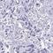 Ubiquitin carboxyl-terminal hydrolase 35 antibody, HPA058592, Atlas Antibodies, Immunohistochemistry paraffin image 
