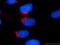 Vesicle Transport Through Interaction With T-SNAREs 1A antibody, 12354-1-AP, Proteintech Group, Immunofluorescence image 