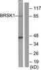 BR Serine/Threonine Kinase 1 antibody, TA315917, Origene, Western Blot image 
