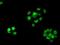 Replication Protein A2 antibody, NBP2-02182, Novus Biologicals, Immunofluorescence image 