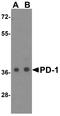 Programmed Cell Death 1 antibody, TA355049, Origene, Western Blot image 