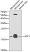 Acid Phosphatase antibody, GTX64698, GeneTex, Western Blot image 