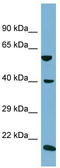 Solute Carrier Family 2 Member 10 antibody, TA333642, Origene, Western Blot image 