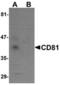 CD81 Molecule antibody, TA306789, Origene, Western Blot image 