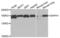 Diaphanous Related Formin 1 antibody, abx004420, Abbexa, Western Blot image 