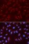 DNA repair protein XRCC3 antibody, orb136503, Biorbyt, Immunocytochemistry image 
