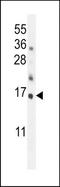 HRK antibody, TA324509, Origene, Western Blot image 