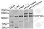 UTP14A Small Subunit Processome Component antibody, A5960, ABclonal Technology, Western Blot image 