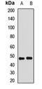 Estrogen Related Receptor Alpha antibody, LS-C667787, Lifespan Biosciences, Western Blot image 