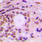 Cyclin F antibody, LS-C351947, Lifespan Biosciences, Immunohistochemistry paraffin image 