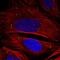 ADAMTS Like 3 antibody, HPA034773, Atlas Antibodies, Immunofluorescence image 