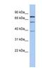 Motile Sperm Domain Containing 2 antibody, NBP1-91438, Novus Biologicals, Western Blot image 
