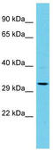 Adaptor Related Protein Complex 1 Associated Regulatory Protein antibody, TA330683, Origene, Western Blot image 