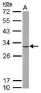Cyclin Dependent Kinase 5 antibody, GTX108328, GeneTex, Western Blot image 