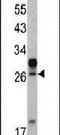 Homeobox A5 antibody, PA5-13653, Invitrogen Antibodies, Western Blot image 