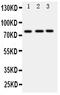 VASA antibody, PA1963, Boster Biological Technology, Western Blot image 
