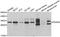 Platelet-derived growth factor subunit B antibody, STJ24934, St John