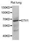 ETV1 antibody, abx005419, Abbexa, Western Blot image 