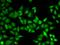 CEN2 antibody, orb167311, Biorbyt, Immunocytochemistry image 