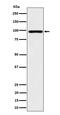 A-Kinase Anchoring Protein 8 antibody, M05133, Boster Biological Technology, Western Blot image 