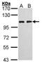 Hepatocyte Growth Factor-Regulated Tyrosine Kinase Substrate antibody, PA5-27491, Invitrogen Antibodies, Western Blot image 
