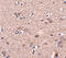 Secretory Carrier Membrane Protein 4 antibody, A16237, Boster Biological Technology, Immunohistochemistry frozen image 