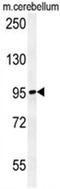 N(Alpha)-Acetyltransferase 25, NatB Auxiliary Subunit antibody, AP50444PU-N, Origene, Western Blot image 